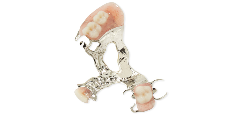 Removable Partial Dentures