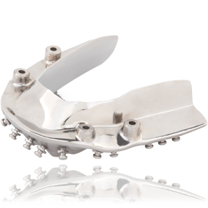 dc_implantbars_overdenture_bar_300