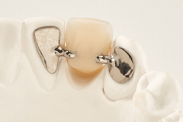 Maryland Retainer