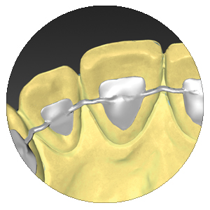 CAD