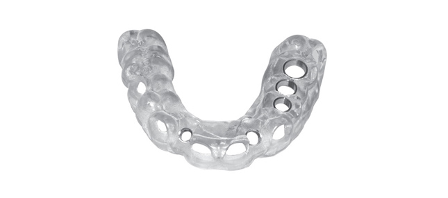 dc_surgeryprocess_Surgical-Guide Patient-specific Surgical Guide