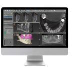 dc_surgeryprocess_Treatment-Proposal-Services Treatment proposal services