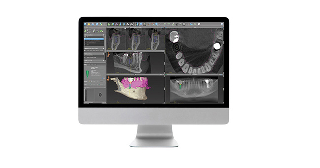 dc_surgeryprocess_Treatment-Proposal-Services Treatment proposal services