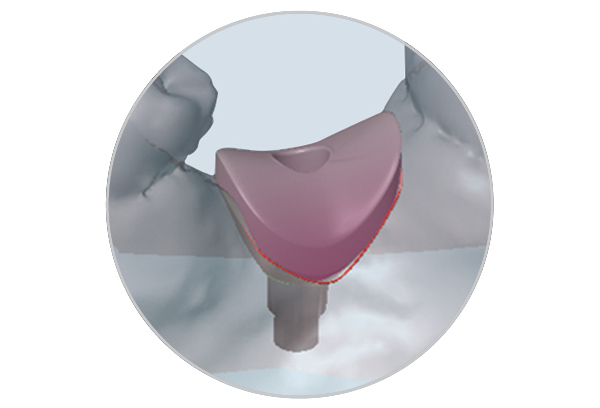 tissue_former_caddesigned CAD designed