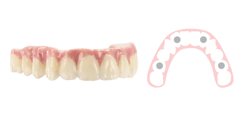 Composite Hybrid