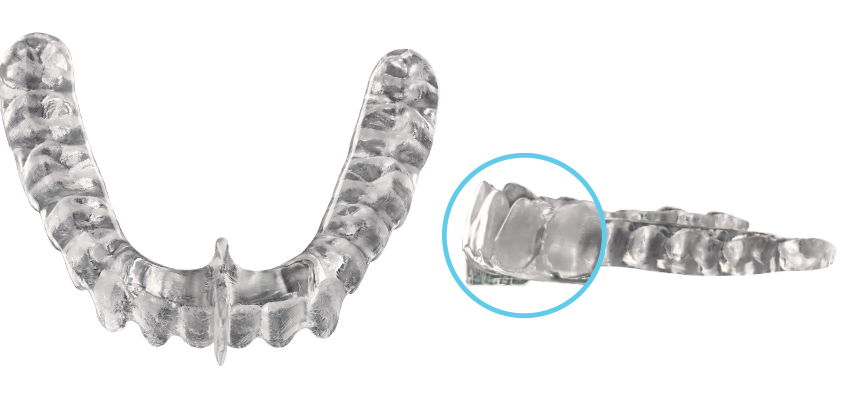 Image_DCN_Full Occlusal Deprogrammer for web Image_DCN_Full Occlusal Deprogrammer for web