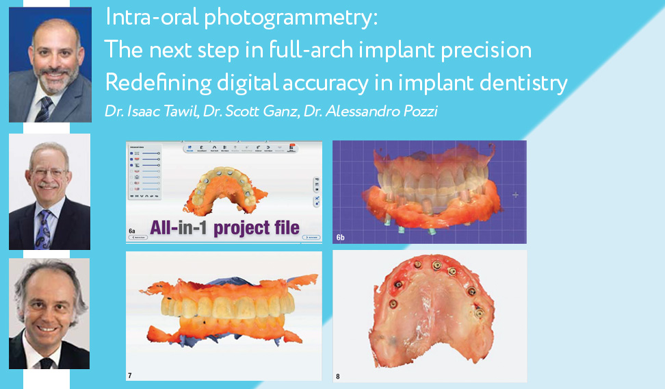 Intraoral Photogrammetry Image